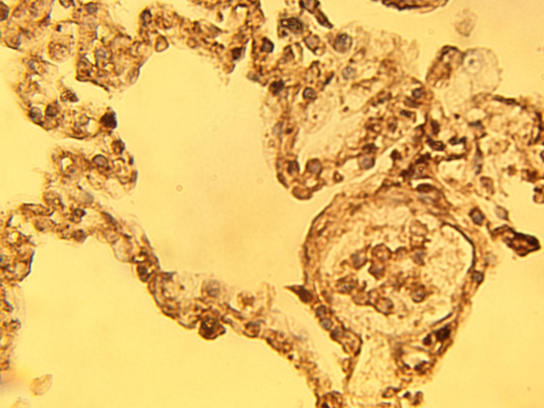 Immunohistochemical staining of normal human lung tissue using SUMO-1 antibody (Cat. No. X2724P) at 15 µg/ml.